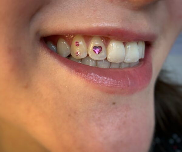 Strass / Babies