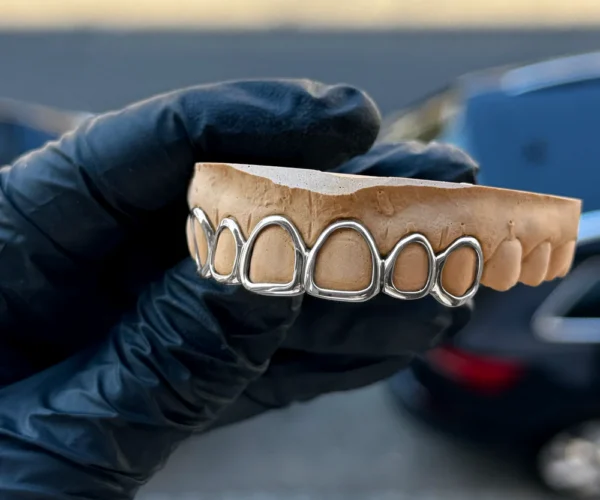 6 dents open