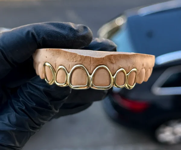 6 dents open